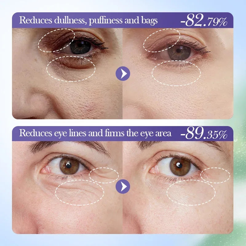 Blueberry Hyaluronic Acid Eye Cream Anti Dark Circles Eyes Bags Remove Firming Moisturizing Eye Creams Beauty Eyes Care Products